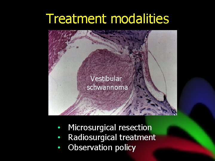 Treatment modalities Vestibular schwannoma • Microsurgical resection • Radiosurgical treatment • Observation policy 