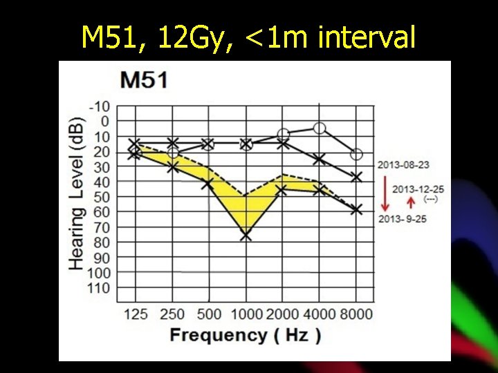 M 51, 12 Gy, <1 m interval 
