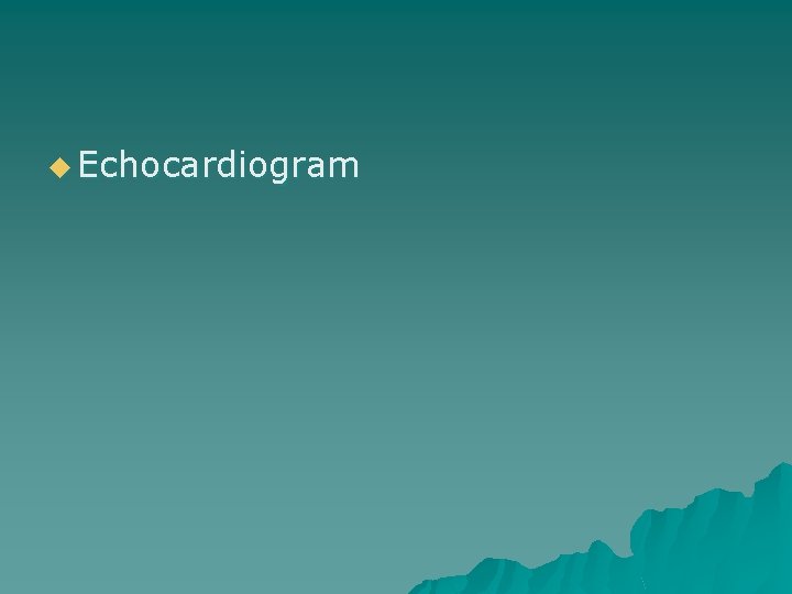 u Echocardiogram 