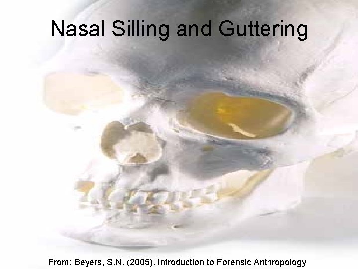 Nasal Silling and Guttering From: Beyers, S. N. (2005). Introduction to Forensic Anthropology 