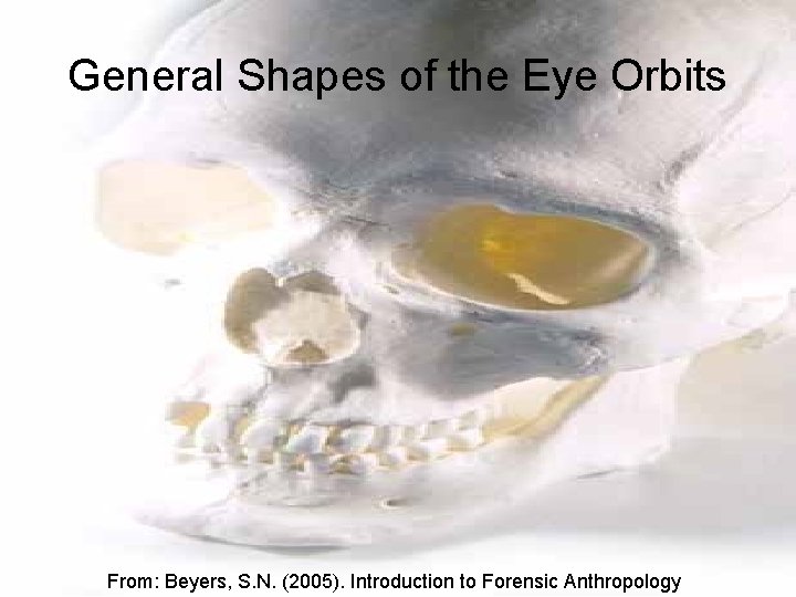 General Shapes of the Eye Orbits From: Beyers, S. N. (2005). Introduction to Forensic