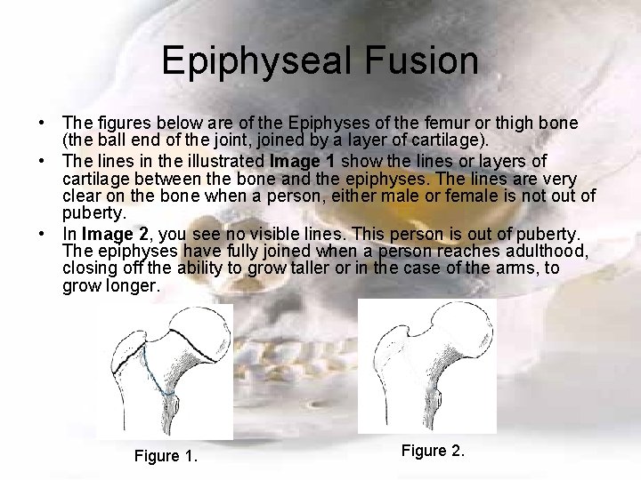 Epiphyseal Fusion • The figures below are of the Epiphyses of the femur or