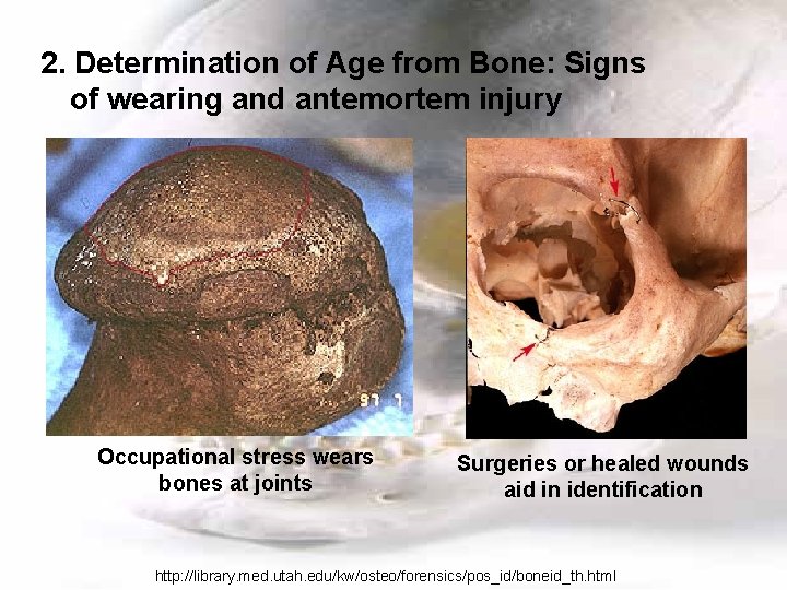 2. Determination of Age from Bone: Signs of wearing and antemortem injury Occupational stress