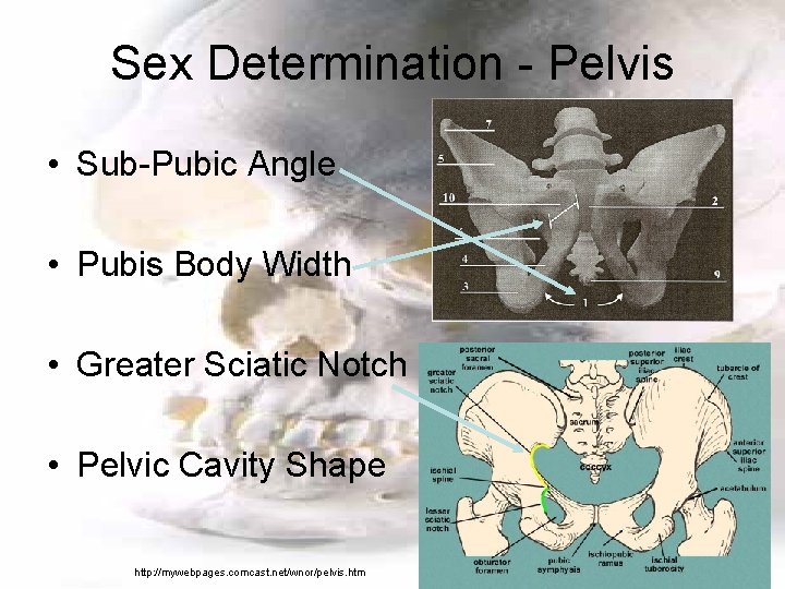 Sex Determination - Pelvis • Sub-Pubic Angle • Pubis Body Width • Greater Sciatic