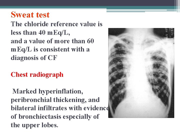 Sweat test The chloride reference value is less than 40 m. Eq/L, and a