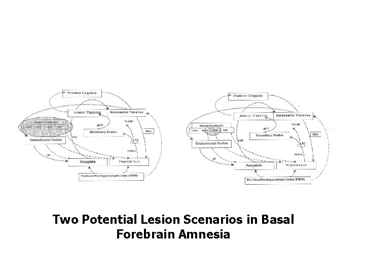 Two Potential Lesion Scenarios in Basal Forebrain Amnesia 