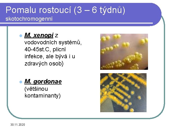 Pomalu rostoucí (3 – 6 týdnů) skotochromogenní l M. xenopi z vodovodních systémů, 40