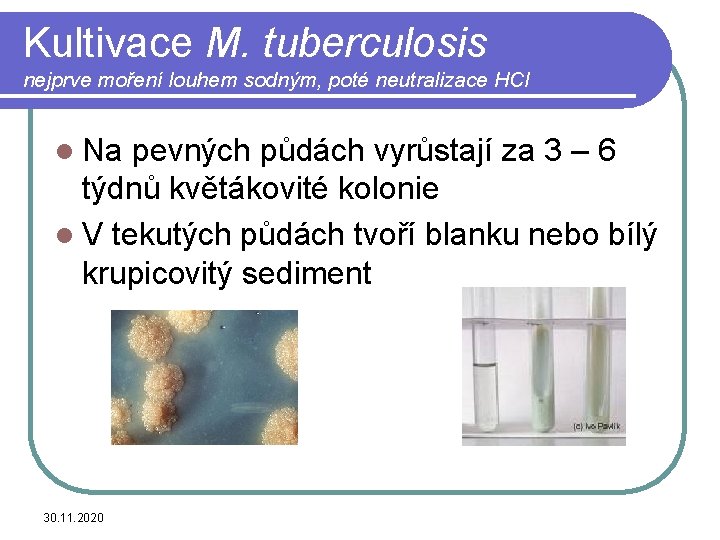 Kultivace M. tuberculosis nejprve moření louhem sodným, poté neutralizace HCl l Na pevných půdách