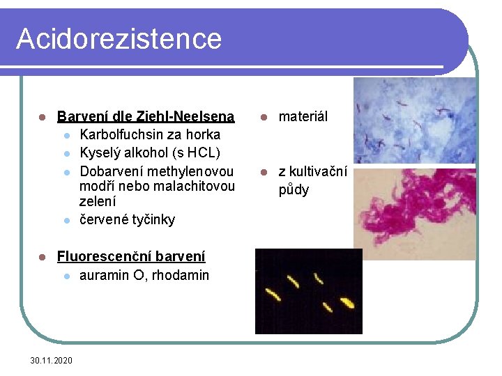 Acidorezistence l l Barvení dle Ziehl-Neelsena l Karbolfuchsin za horka l Kyselý alkohol (s