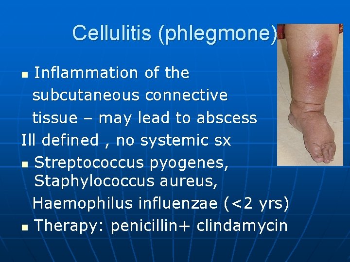 Cellulitis (phlegmone) Inflammation of the subcutaneous connective tissue – may lead to abscess Ill