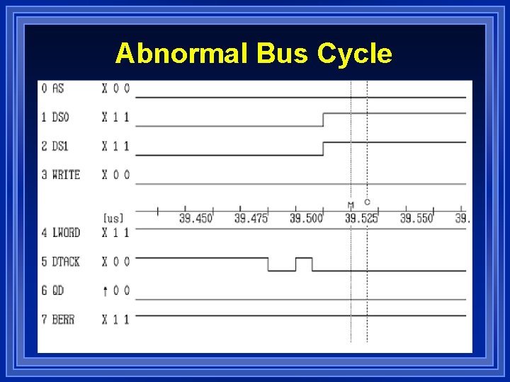 Abnormal Bus Cycle 