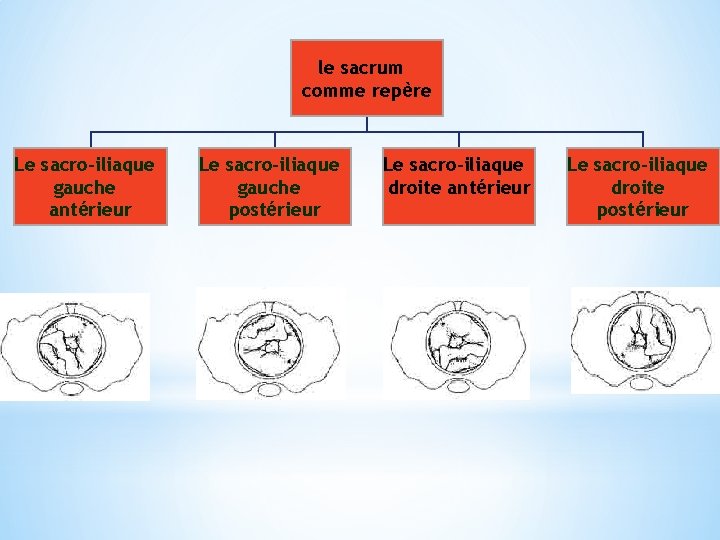 le sacrum comme repère Le sacro-iliaque gauche antérieur Le sacro-iliaque gauche postérieur Le sacro-iliaque