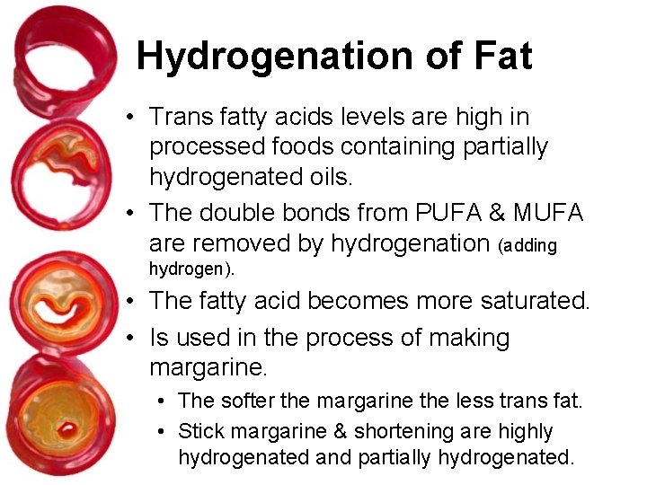 Hydrogenation of Fat • Trans fatty acids levels are high in processed foods containing