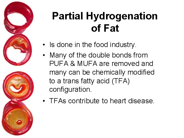Partial Hydrogenation of Fat • Is done in the food industry. • Many of