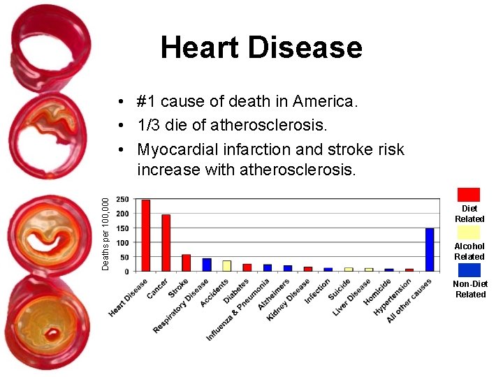 Heart Disease Deaths per 100, 000 • #1 cause of death in America. •