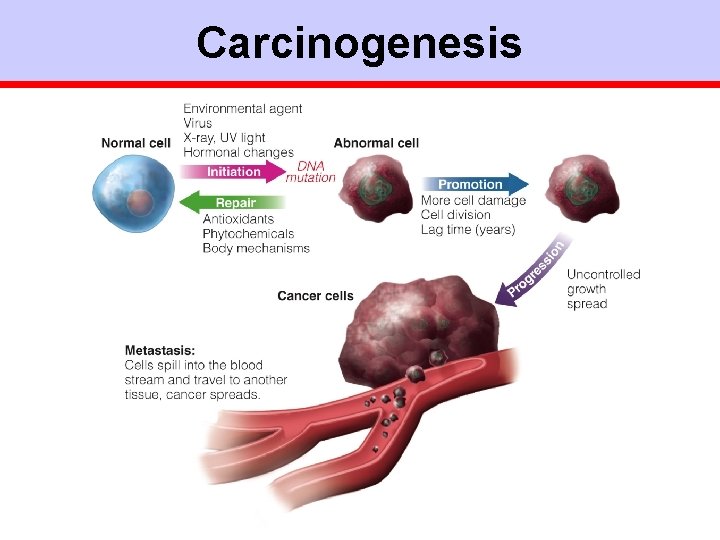 Carcinogenesis 