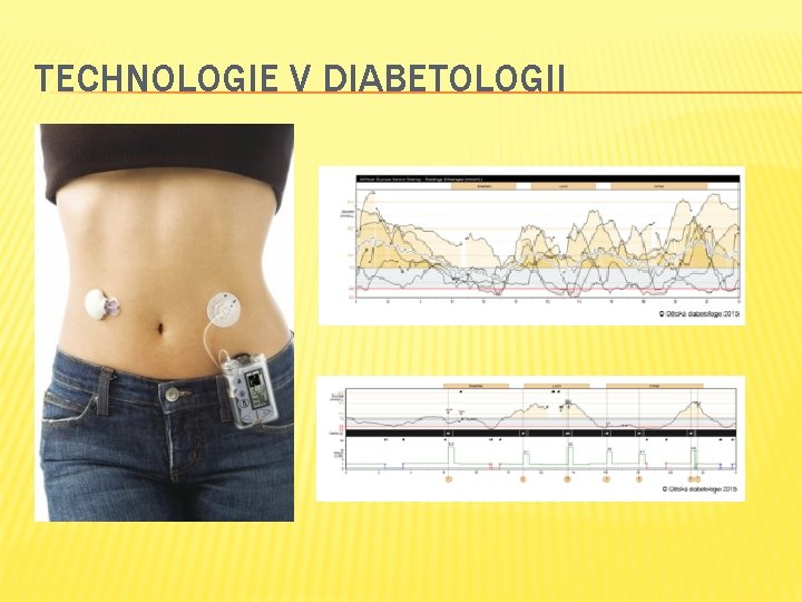 TECHNOLOGIE V DIABETOLOGII 