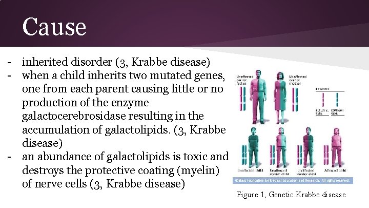 Cause - inherited disorder (3, Krabbe disease) - when a child inherits two mutated