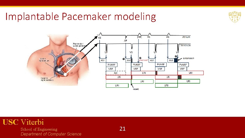 Implantable Pacemaker modeling USC Viterbi School of Engineering Department of Computer Science 21 