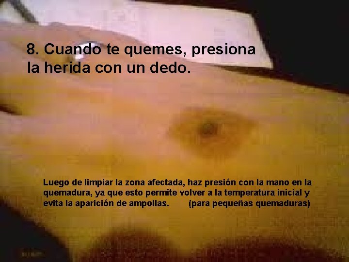 8. Cuando te quemes, presiona la herida con un dedo. Luego de limpiar la
