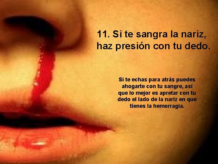 11. Si te sangra la nariz, haz presión con tu dedo. Si te echas
