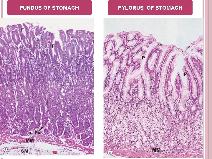 FUNDUS OF STOMACH PYLORUS OF STOMACH 