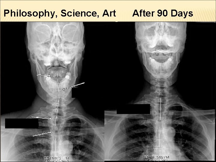 Philosophy, Science, Art After 90 Days Dave 56 Years Old 15 Years of High