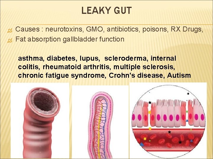 LEAKY GUT Causes : neurotoxins, GMO, antibiotics, poisons, RX Drugs, Fat absorption gallbladder function