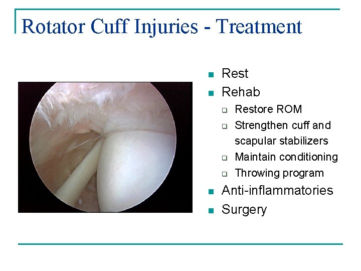 Rotator Cuff Injuries - Treatment n n Rest Rehab q q n n Restore