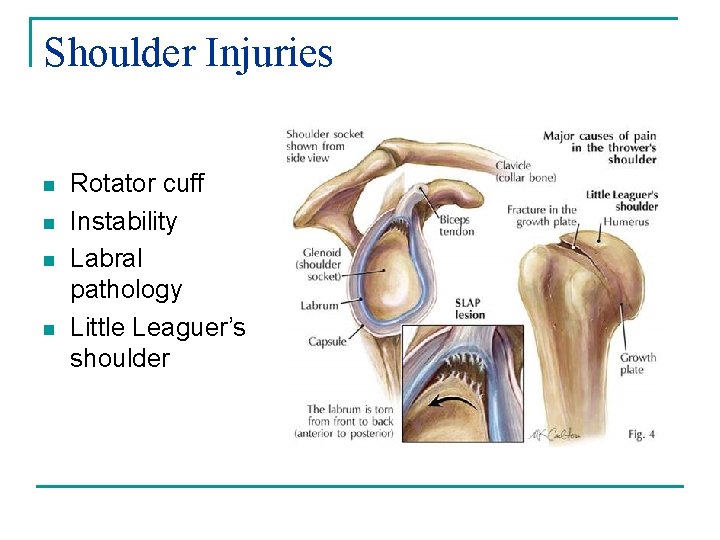 Shoulder Injuries n n Rotator cuff Instability Labral pathology Little Leaguer’s shoulder 