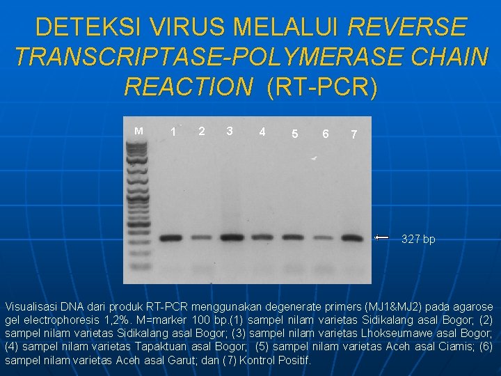 DETEKSI VIRUS MELALUI REVERSE TRANSCRIPTASE-POLYMERASE CHAIN REACTION (RT-PCR) M 1 2 3 4 5