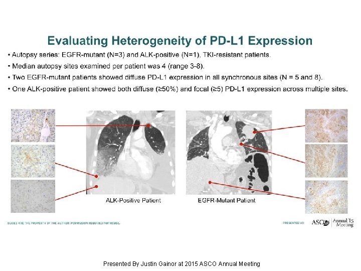 Slide 14 Presented By Justin Gainor at 2015 ASCO Annual Meeting 