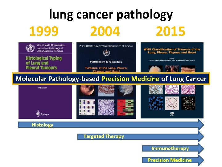 lung cancer pathology 1999 2004 2015 Molecular Pathology-based Precision Medicine of Lung Cancer Histology