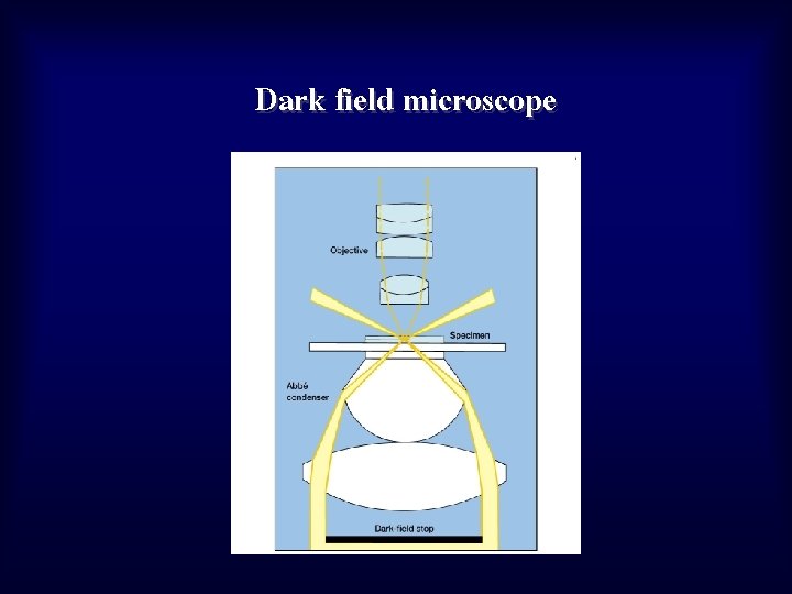 Dark field microscope 