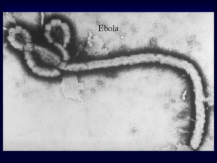 Ebola 