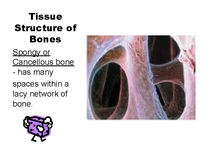 Tissue Structure of Bones Spongy or Cancellous bone - has many spaces within a
