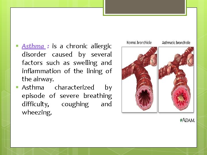 § Asthma : is a chronic allergic disorder caused by several factors such as
