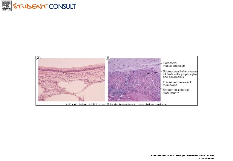 Downloaded from: Student. Consult (on 18 November 2008 01: 51 PM) © 2005 Elsevier