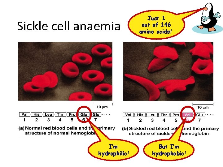 Sickle cell anaemia I’m hydrophilic! Just 1 out of 146 amino acids! But I’m