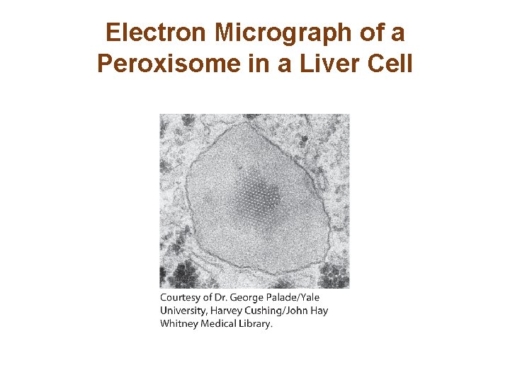 Electron Micrograph of a Peroxisome in a Liver Cell 