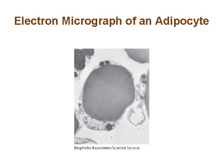 Electron Micrograph of an Adipocyte 
