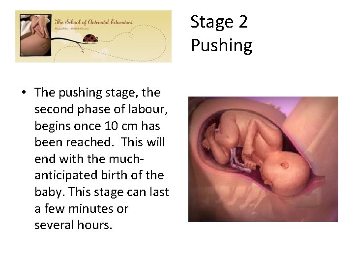 Stage 2 Pushing • The pushing stage, the second phase of labour, begins once