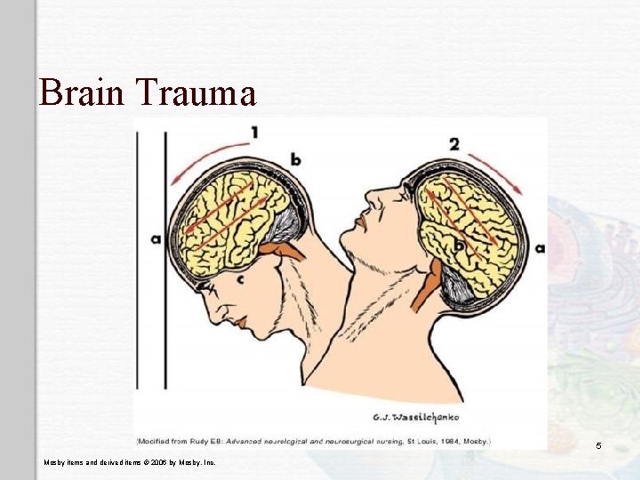 Brain Trauma 5 Mosby items and derived items © 2006 by Mosby, Inc. 