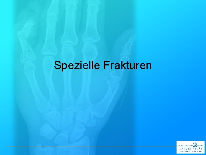 Spezielle Frakturen 