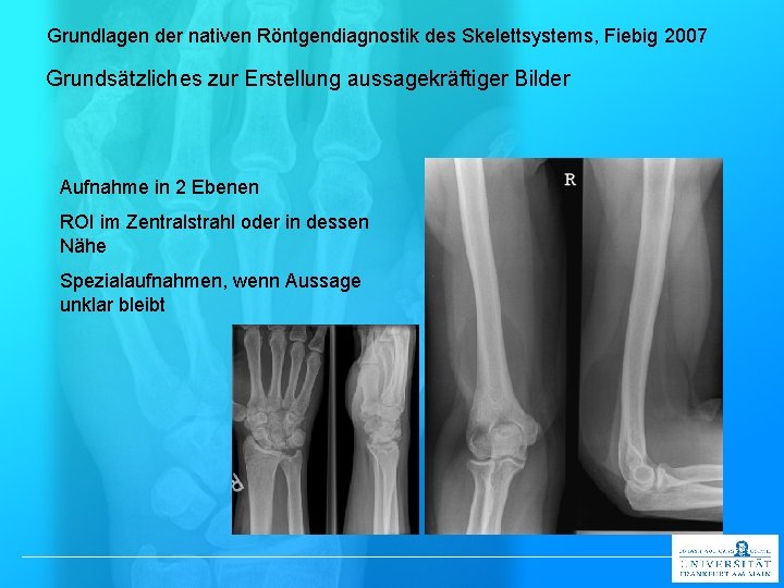 Grundlagen der nativen Röntgendiagnostik des Skelettsystems, Fiebig 2007 Grundsätzliches zur Erstellung aussagekräftiger Bilder Aufnahme