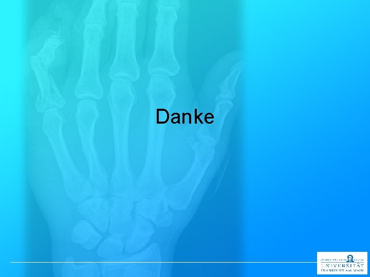 Danke 