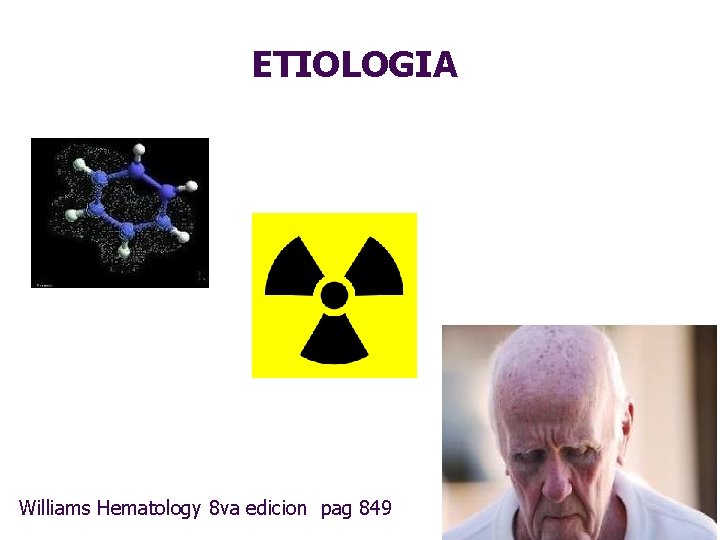 ETIOLOGIA Williams 12/17/2021 Hematology 8 va edicion pag 849 