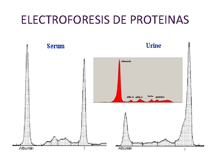 ELECTROFORESIS DE PROTEINAS 