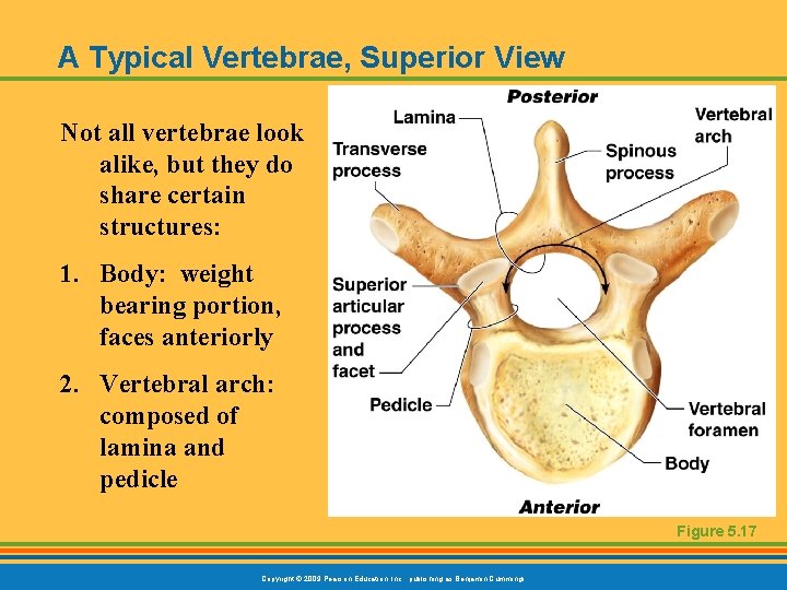 A Typical Vertebrae, Superior View Not all vertebrae look alike, but they do share