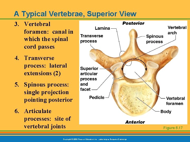 A Typical Vertebrae, Superior View 3. Vertebral foramen: canal in which the spinal cord